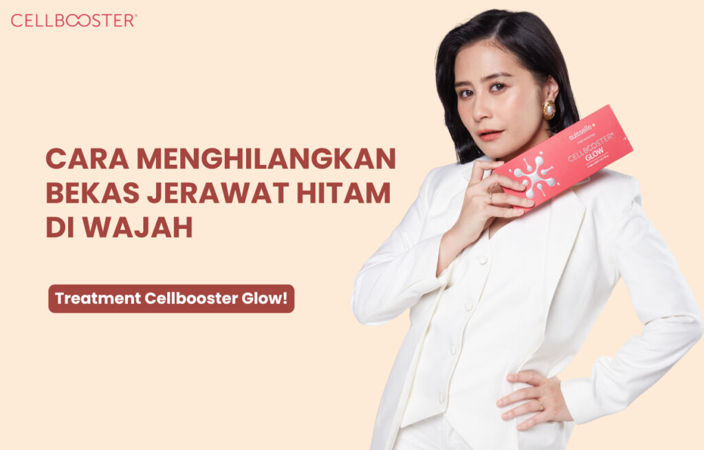 Cara Menghilangkan Bekas Jerawat di Wajah