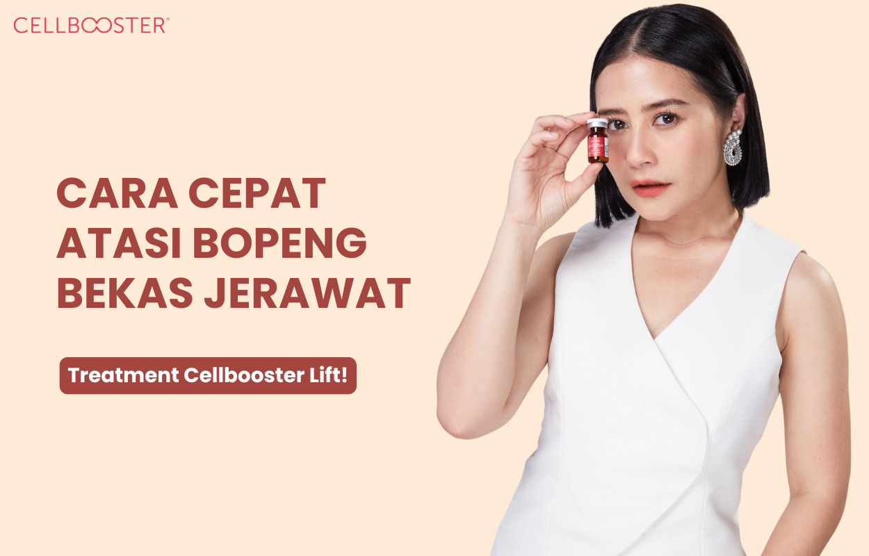 Cara Menghilangkan Bopeng di Pipi secara Alami