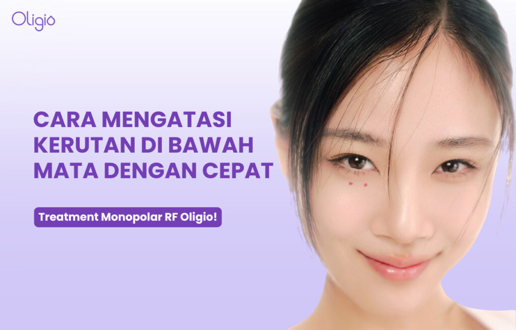 Cara Mengatasi Kerutan di Mata