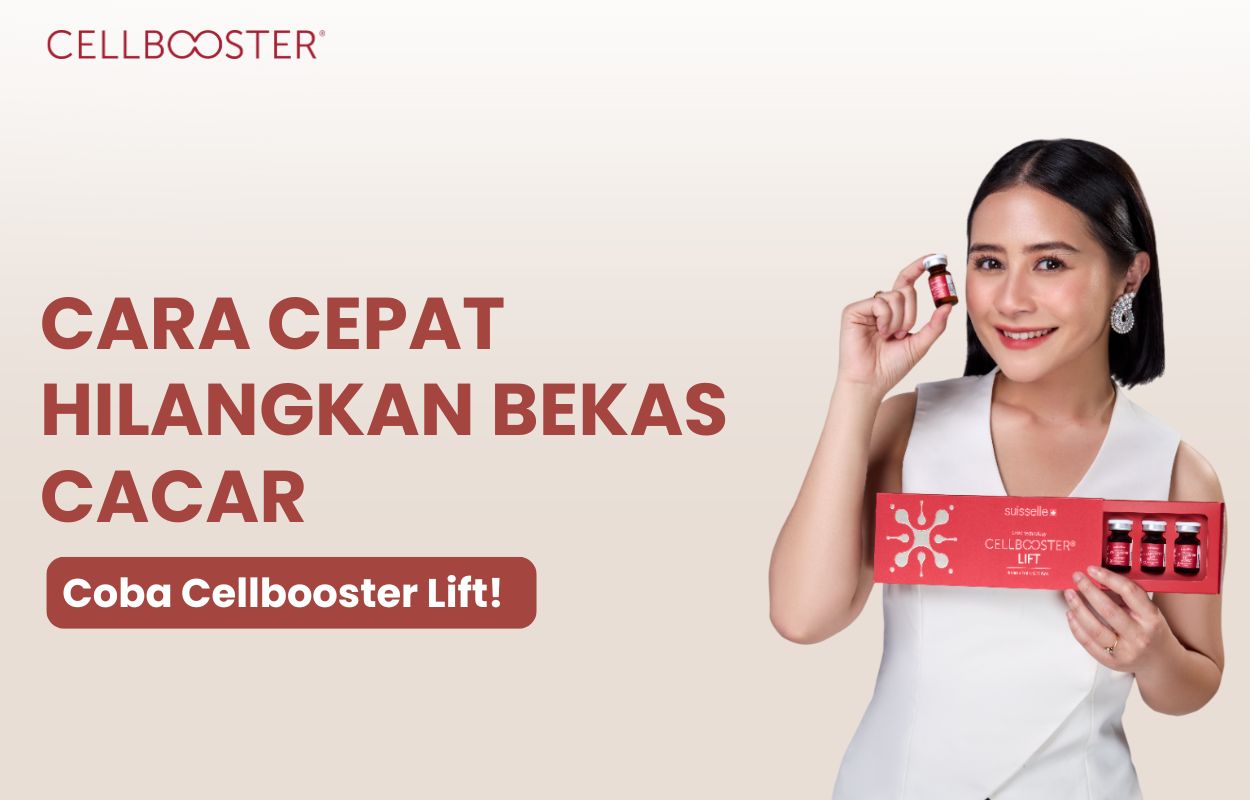 cara menghilangkan bekas cacar air