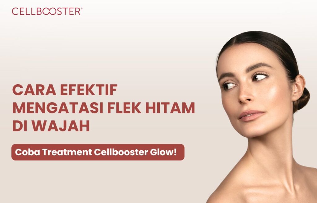 cara mengatasi flek hitam di wajah