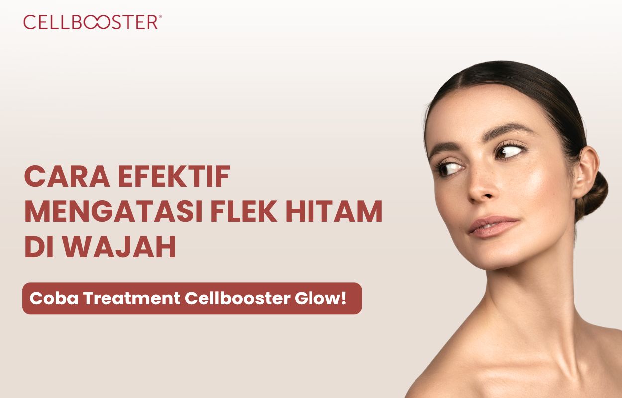 cara mengatasi flek hitam di wajah