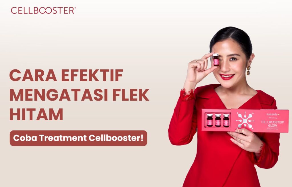 mengatasi flek hitam di wajah