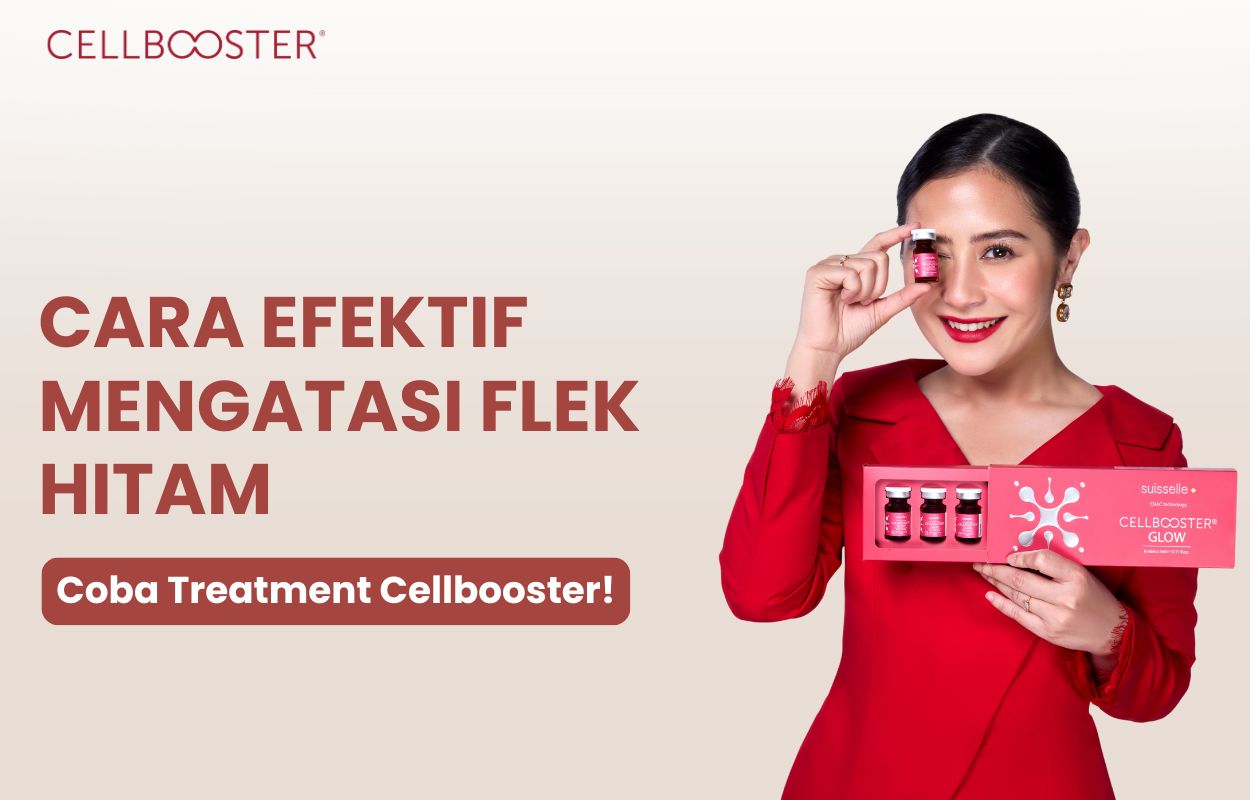 mengatasi flek hitam di wajah