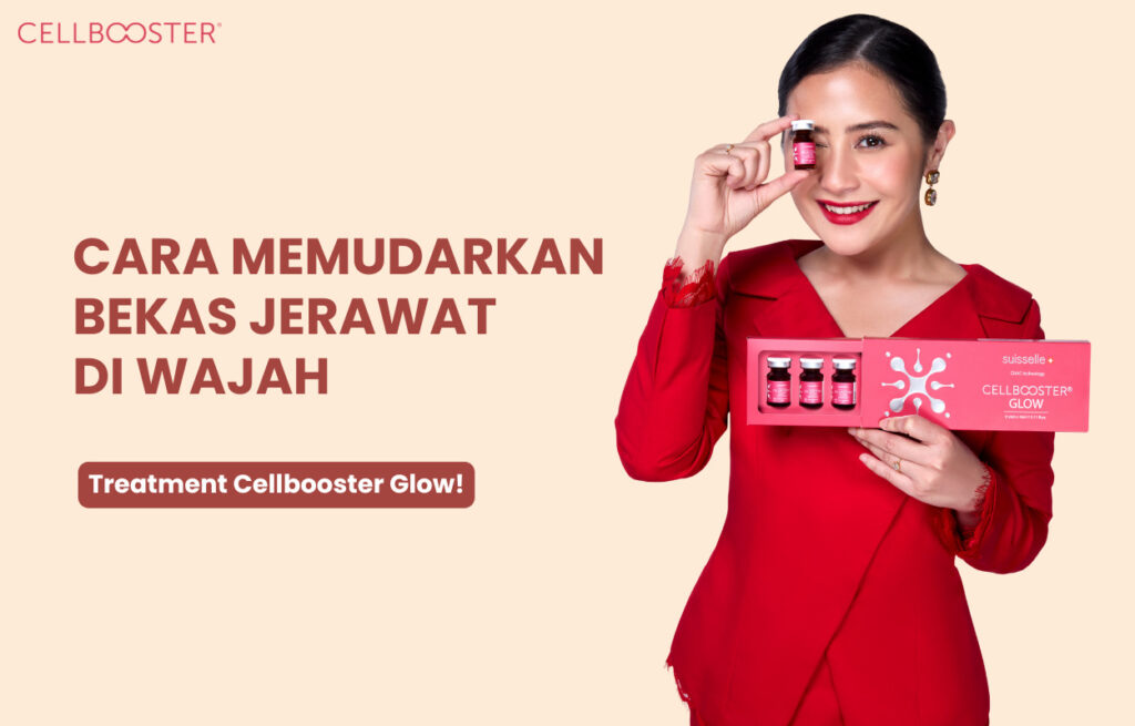 Noda Hitam di Wajah Bekas Jerawat