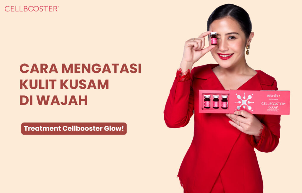 Cara Menghilangkan Kulit Kusam di Wajah