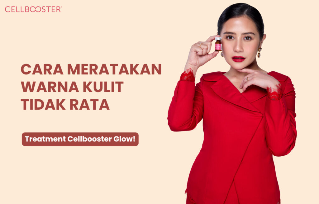 Warna Kulit Tidak Rata