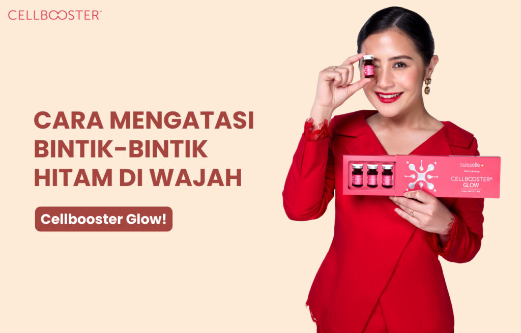 Cara Mengatasi Bintik-bintik Hitam di Wajah