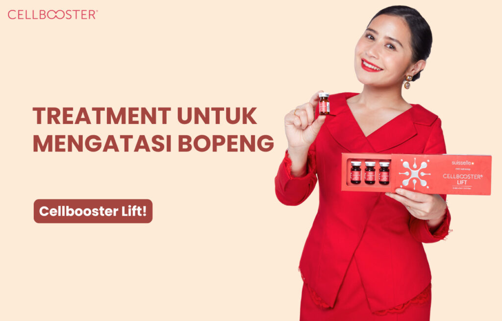 Treatment Menghilangkan Bopeng