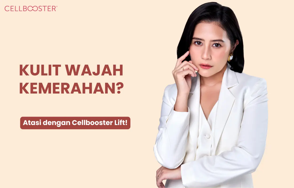 Mengatasi Kulit Kemerahan