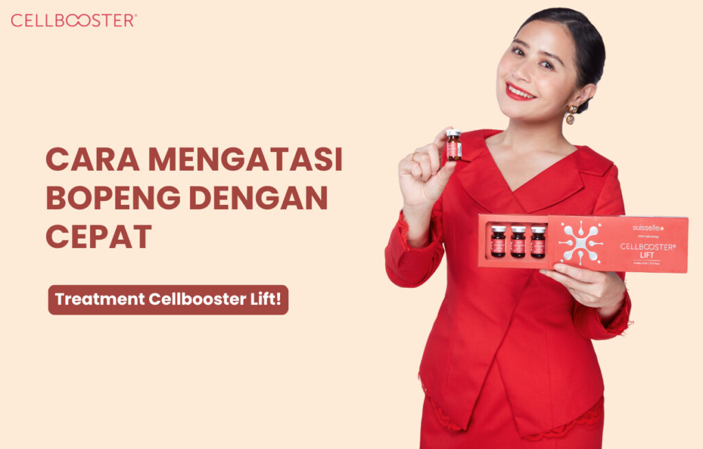 Penyebab Kulit Wajah Bopeng