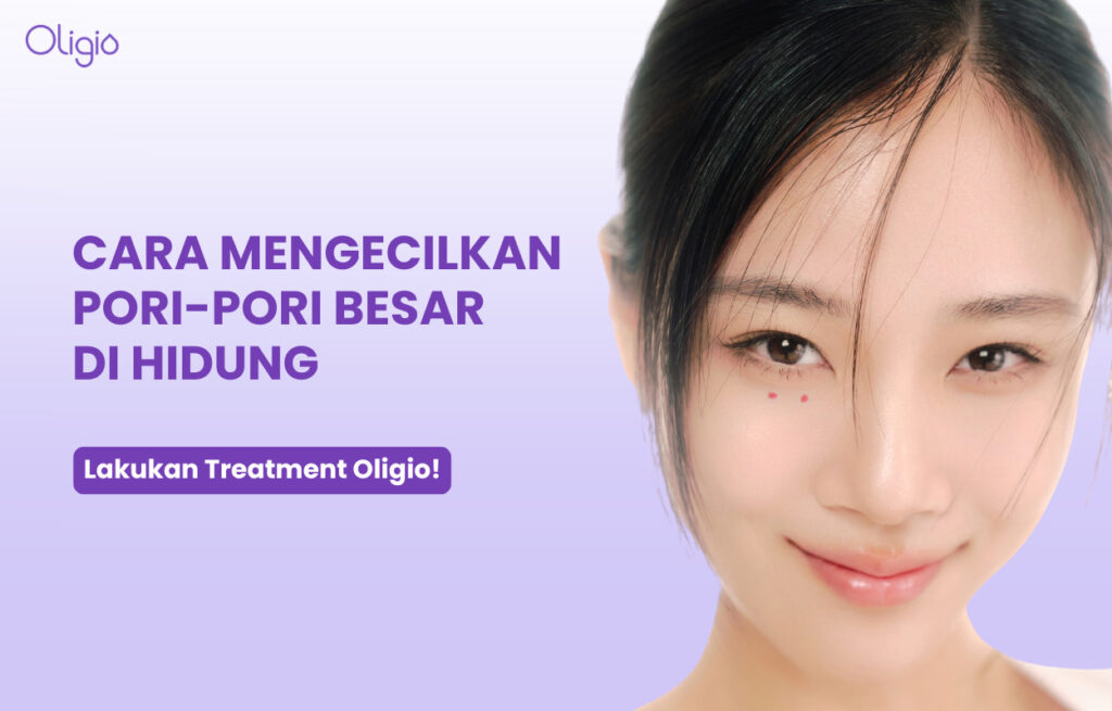 Cara Menghilangkan Pori-Pori Besar di Hidung
